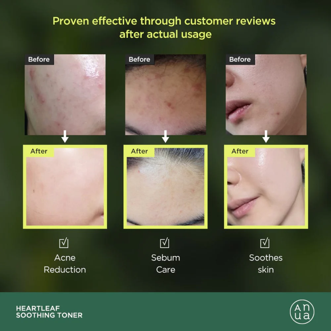 Heartleaf 77 Soothing Toner - Tónico Hidratante y Calmante
