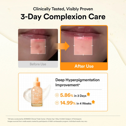 Glutathiosome Dark Spot Serum Vita Drop - Suero Iluminador Antimanchas