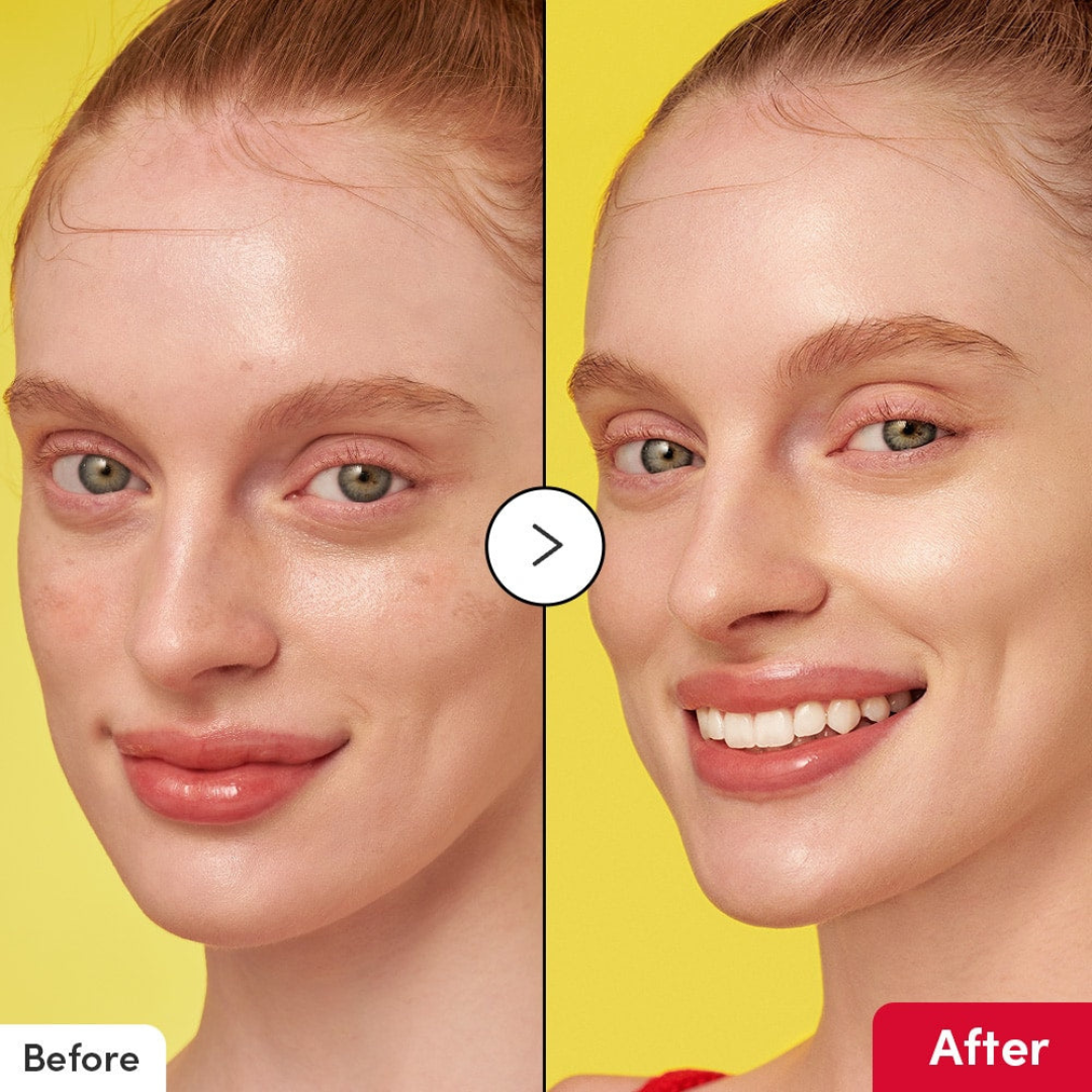 Vitamin Illuminating Serum - Suero Iluminador Antimanchas