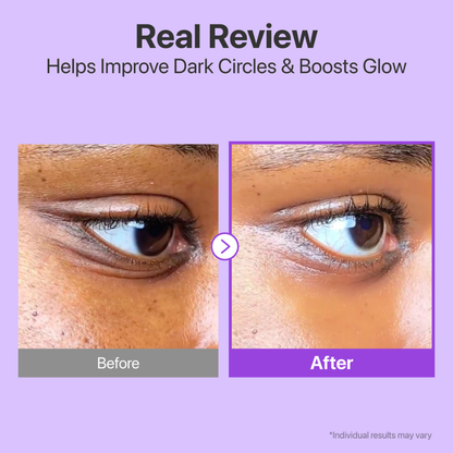No.9 NAD+ Retinol Volumetox Eye Cream - Crema de Ojos Antiedad