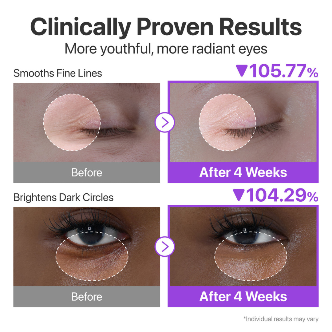 No.9 NAD+ Retinol Volumetox Eye Cream - Crema de Ojos Antiedad