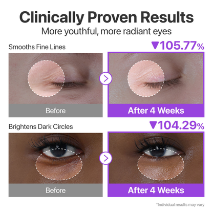 No.9 NAD+ Retinol Volumetox Eye Cream - Crema de Ojos Antiedad