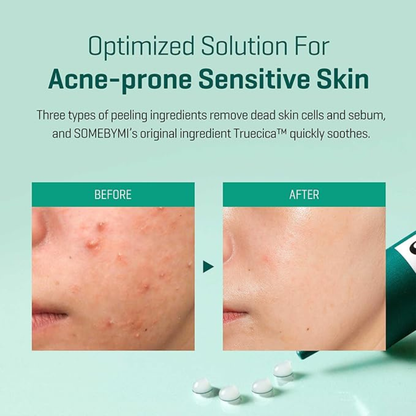 AHA.BHA.PHA 14 Days Super Miracle Spot All Kill Cream - Tratamiento Antiacné