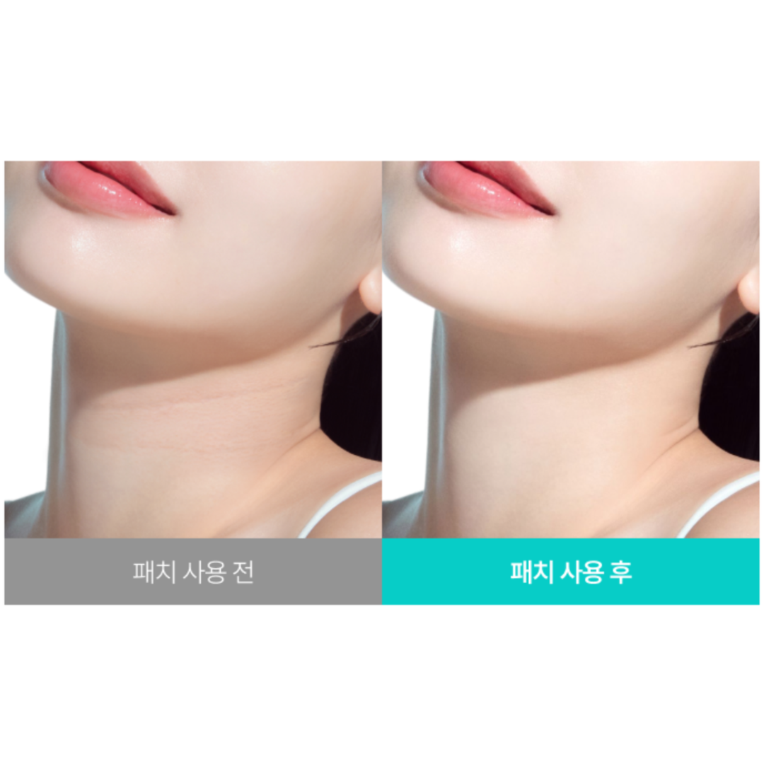 PDRN Collagen Melting Patch for Glass Neck - Parches Reafirmantes para Cuello
