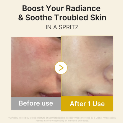 Kojic Acid Turmeric Vita Jelly Mist Serum - Mist Despigmentante