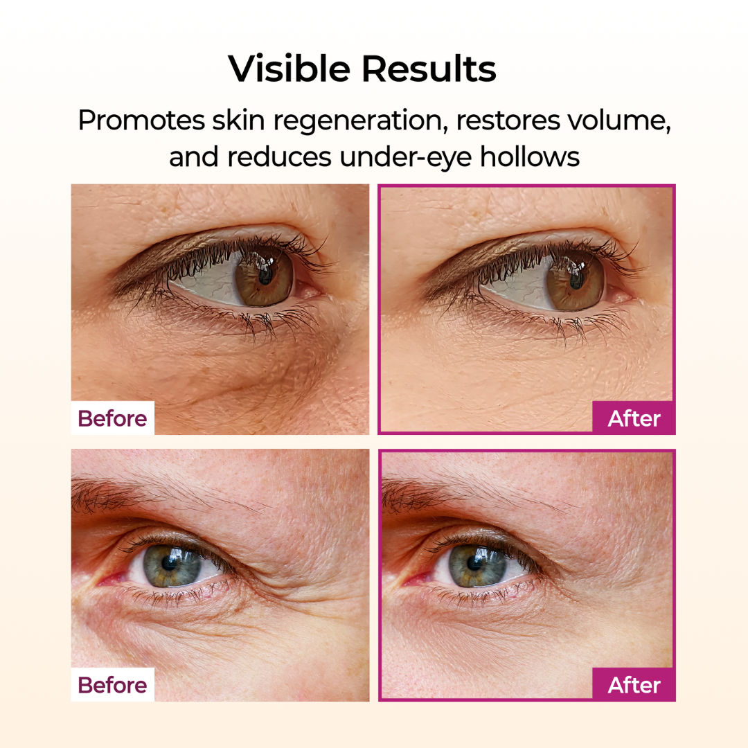 Cemenrete Calcium Volume Multi Balm - Bálsamo Voluminizador