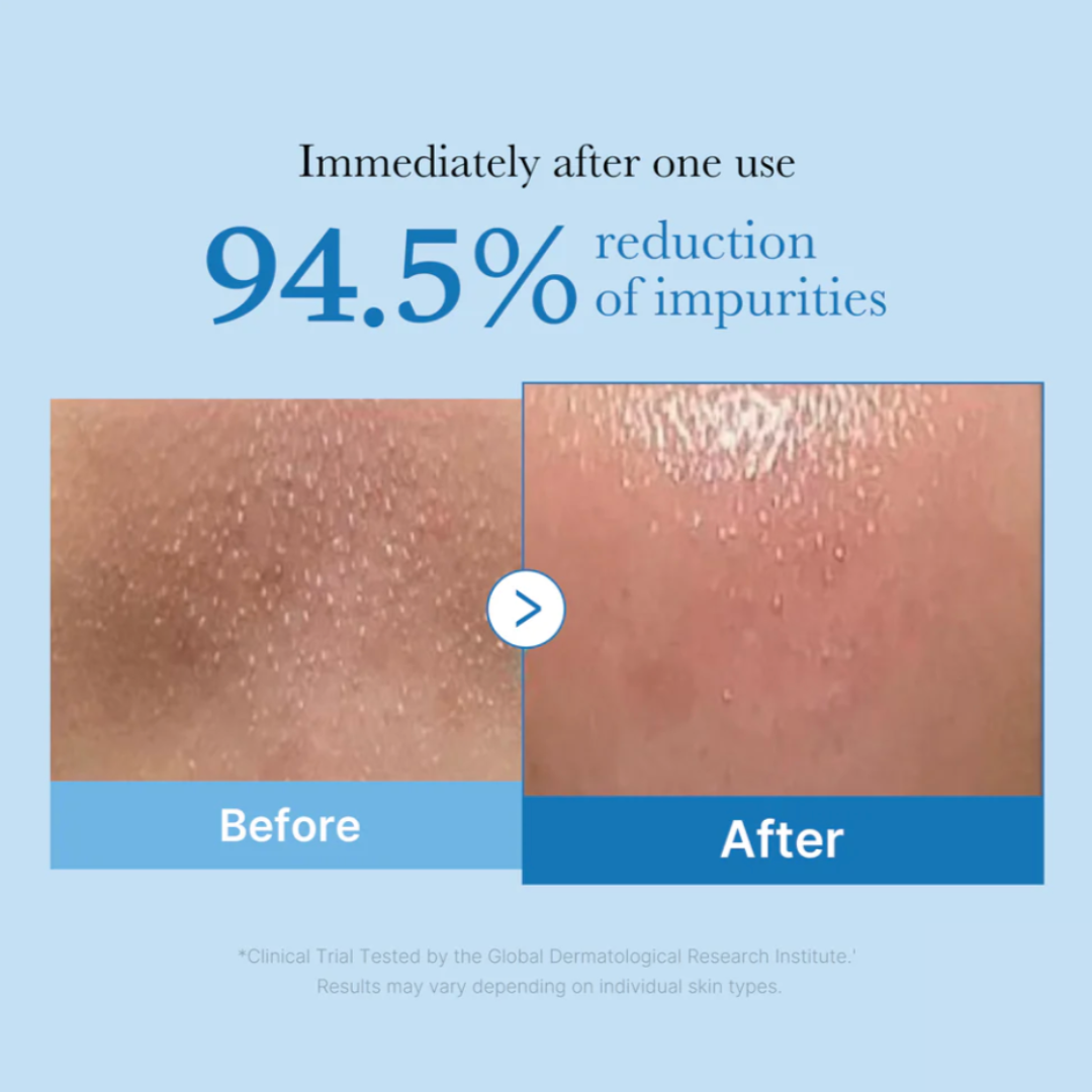 Zero Pore Blackhead Deep Cleansing Oil - Limpiador a Base de Aceite