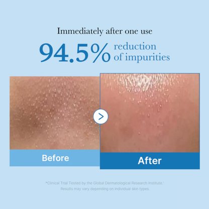 Zero Pore Blackhead Deep Cleansing Oil - Limpiador a Base de Aceite