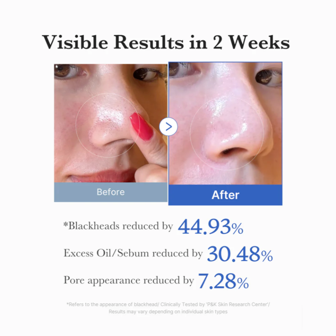 Zero Pore Pad - Pads Exfoliantes para Poros