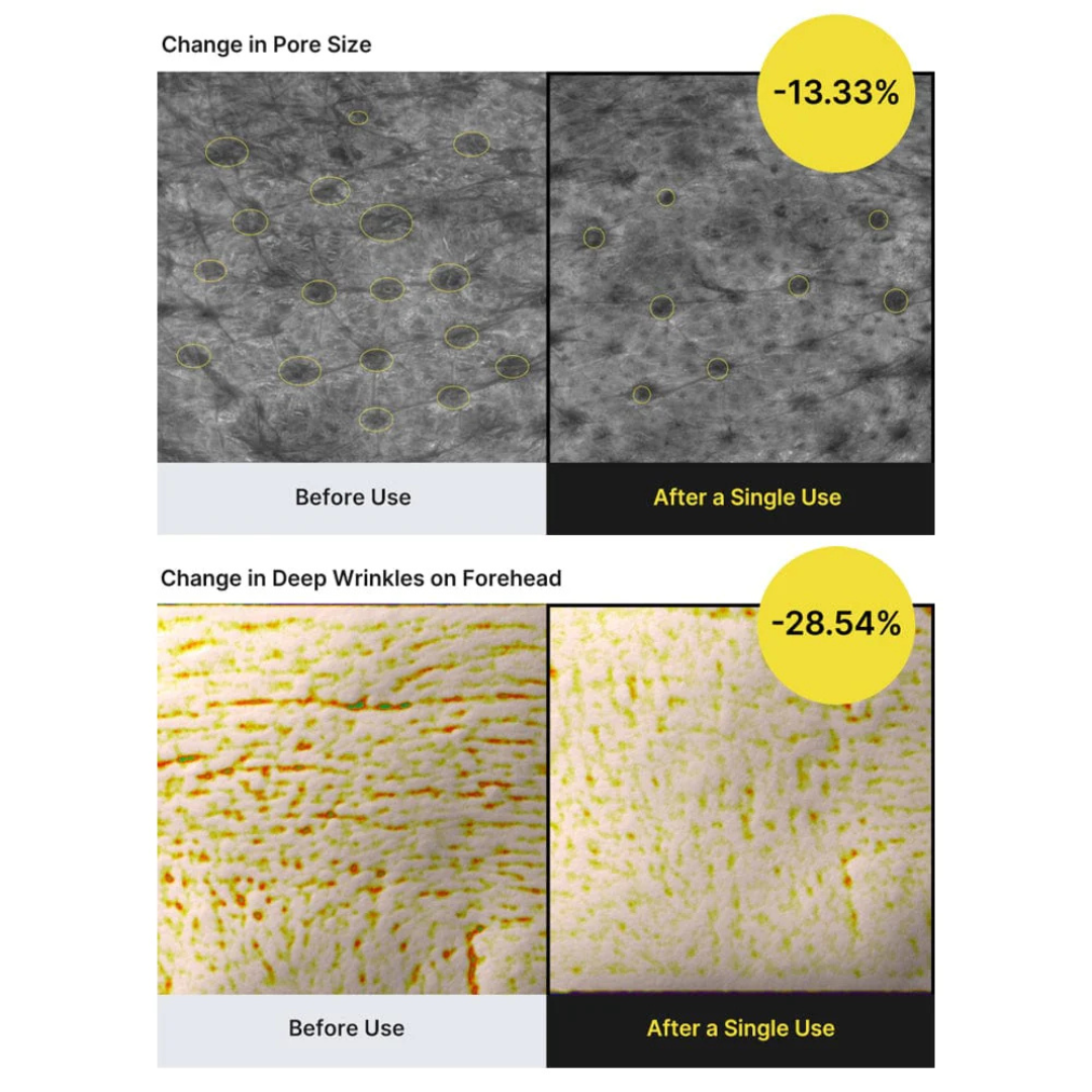 The Vita A Retinal Shot Tightening Booster - Booster Antiedad