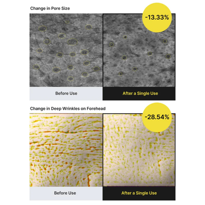 The Vita A Retinal Shot Tightening Booster - Booster Antiedad